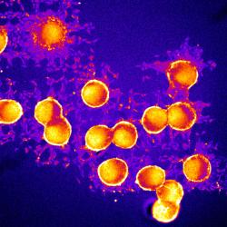 neuron spheroids on a chip designed to control the communication channels between the neuron cells. Color shows the firing activity of the cells.